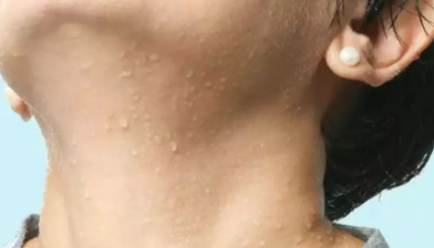 滿月發汗真的能預防月子病嗎 滿月發汗有什么用