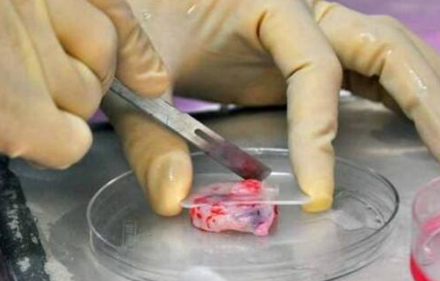 英國醫生發明卵巢移植法 卵巢移植有什么用 英國醫生發明卵巢移植法 卵巢移植有什么用