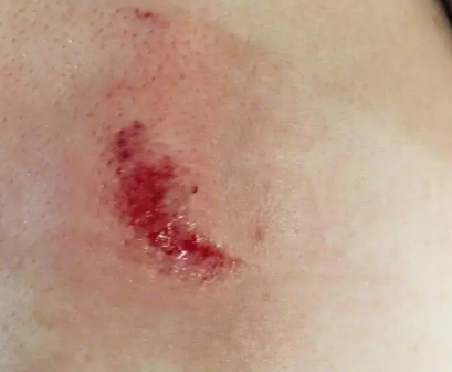 張馨予媽媽受傷是怎么回事 張馨予媽媽被柜子砸傷了嗎 張馨予媽媽受傷是怎么回事 張馨予媽媽被柜子砸傷了嗎