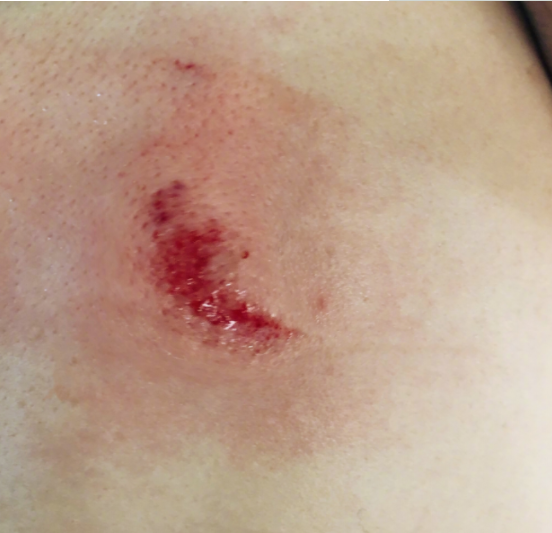 張馨予媽媽受傷是什么情況 張馨予媽媽是怎么受傷的