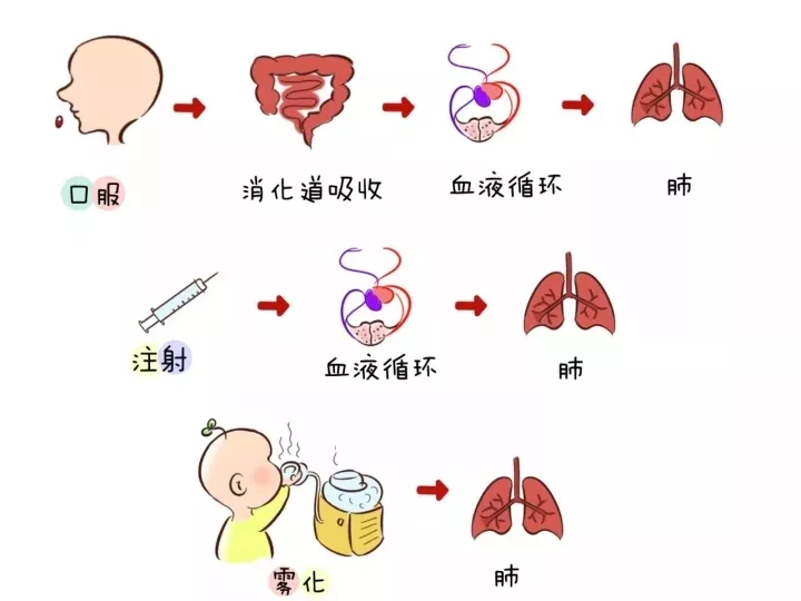 孩子咳嗽為什么醫(yī)生開霧化不開止咳藥 孩子霧化有激素嗎