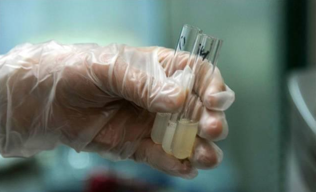 無(wú)精癥射出來(lái)是什么顏色 無(wú)精癥要做哪些檢查項(xiàng)目 無(wú)精癥射出來(lái)是什么顏色 無(wú)精癥要做哪些檢查項(xiàng)目