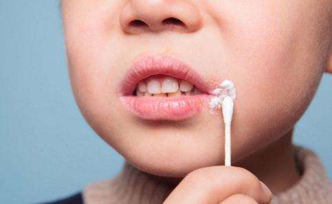 孩子嘴唇干裂是為什么 孩子嘴唇干裂怎么辦 孩子嘴唇干裂是為什么 孩子嘴唇干裂怎么辦