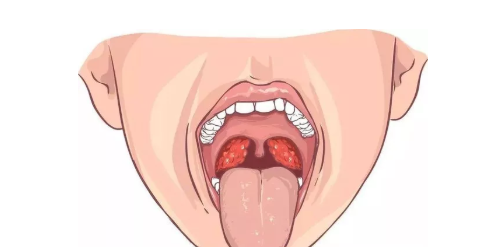 寶寶很小就打呼嚕怎么回事 寶寶很小就打呼嚕的原因