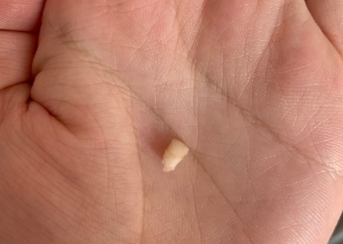 寶寶掉第一顆牙紀念語 寶寶掉第一顆牙齒說說