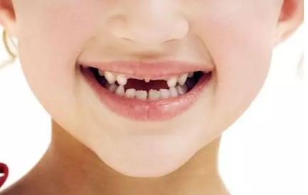 寶寶掉第一顆牙紀念語 寶寶掉第一顆牙齒說說