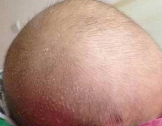 寶寶睡覺為什么總是流汗 寶寶晚上睡覺流汗多是怎么回事