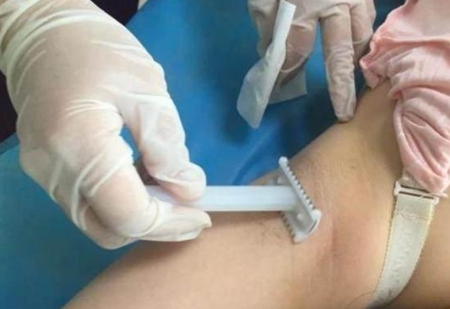 生產(chǎn)前為什么要刮毛 產(chǎn)婦可以自己在家備皮嗎