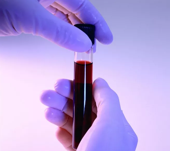 香港驗血鑒別男女準確率是多少 香港驗血什么時候最準確