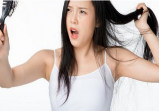 脫發是什么原因導致的 平時如何預防脫發