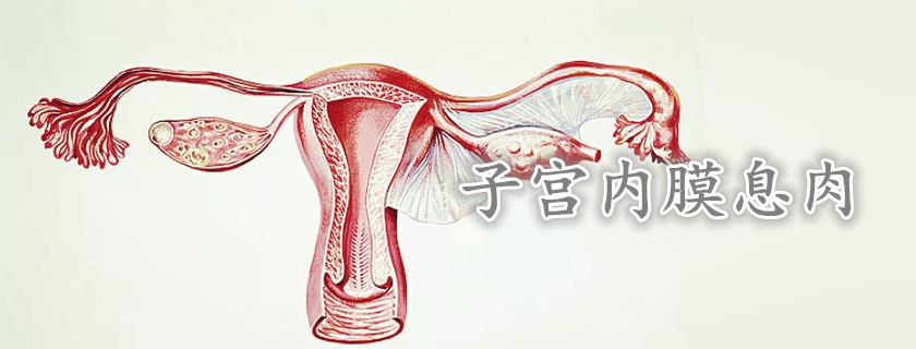 子宮內膜息肉患能吃黃體酮治療嗎 子宮息肉可以自然消退嗎