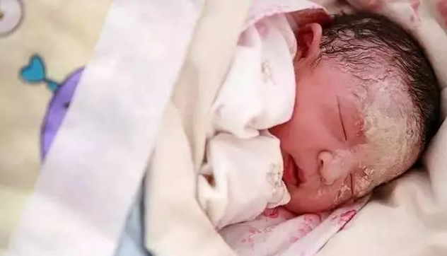 寶寶身上白色的胎脂要不要清除 保留胎脂對寶寶有什么作用