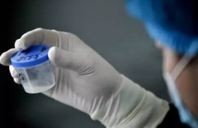 精子過多有什么影響 男性精子過多會有什么影響