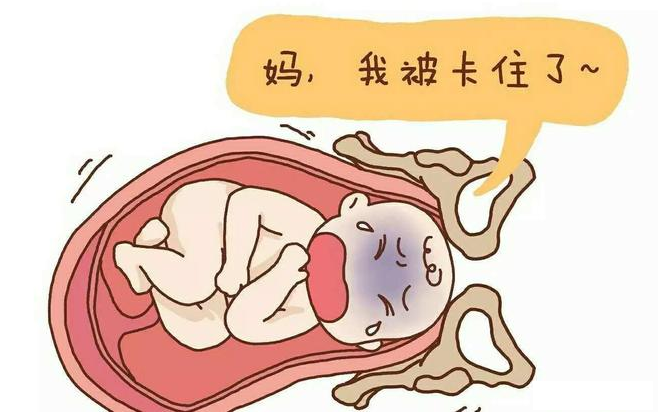 生產時如何避免側切 側切后多久可以啪啪啪