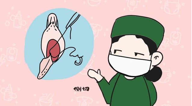 生產時如何避免側切 側切后多久可以啪啪啪