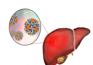 乙肝能做試管嬰兒嗎 乙肝做試管嬰兒要注意什么