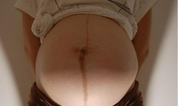 孕婦肚臍眼發黑正常嗎 孕婦肚臍眼發黑如何改善 孕婦肚臍眼發黑正常嗎 孕婦肚臍眼發黑如何改善