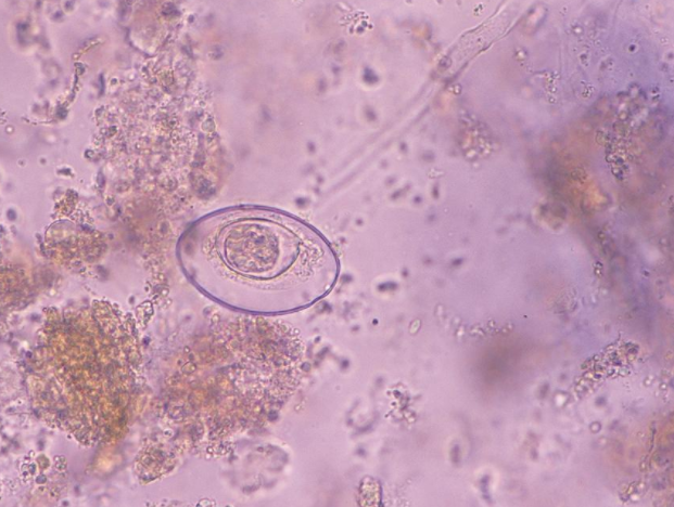 什么是供卵試管嬰兒 哪些人群可以做供卵試管嬰兒