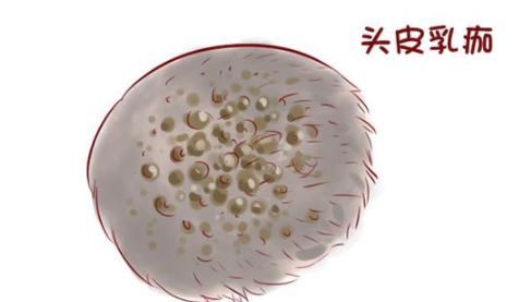 新生兒頭上有臟東西怎么辦 新生兒頭垢怎么清理
