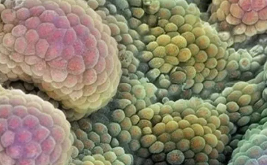 前列腺切除后還有性功能嗎 前列腺切除后有什么影響 前列腺切除后還有性功能嗎 前列腺切除后有什么影響