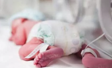 早產(chǎn)寶寶應(yīng)該怎么照顧 早產(chǎn)兒的照顧方法