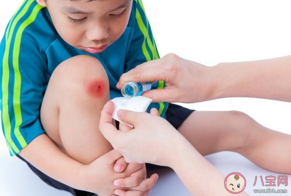 寶寶跌倒后如何消腫 寶寶跌倒后該怎么處理