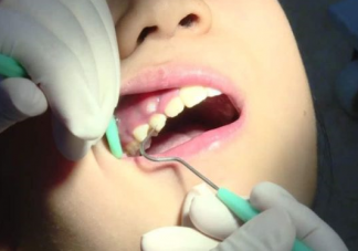 嬰兒口腔護理什么時候開始好 嬰兒口腔護理操作流程是什么