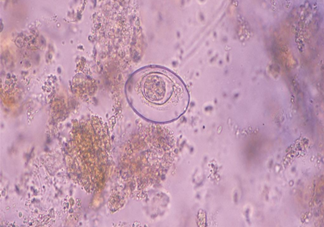 為什么供卵試管嬰兒成功率高 供卵試管嬰兒要用多少個卵子