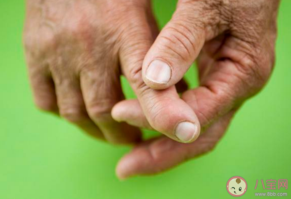 風濕關節疼該怎么辦 風濕關節疼是怎么回事 風濕關節疼該怎么辦 風濕關節疼是怎么回事