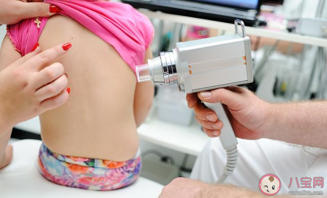 寶寶長胎記需要處理嗎 為什么寶寶會長胎記