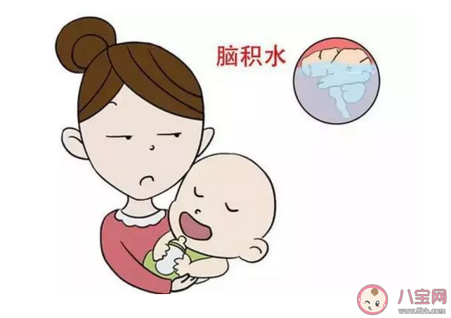 孩子的囟門閉合得晚是不是智力不太好 孩子的囟門閉合時間會有什么影響