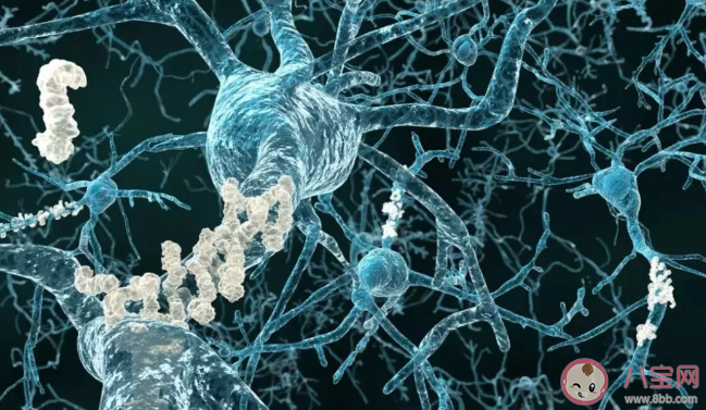 睡不夠更易導致腹部肥胖是真的嗎 腹部肥胖怎么減肥