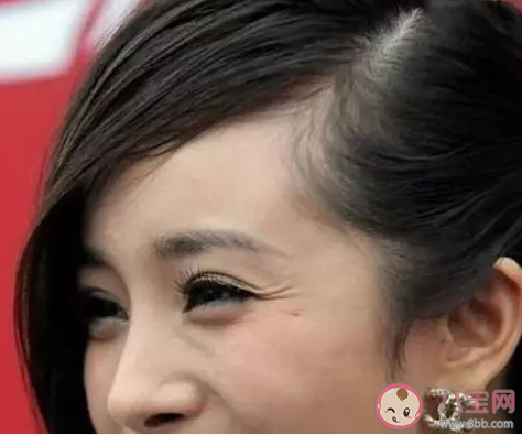 割眼袋會有什么風險 做眼袋手術會有后遺癥嗎 割眼袋會有什么風險 做眼袋手術會有后遺癥嗎