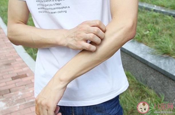 為什么會得蕁麻疹 得了蕁麻疹怎么辦