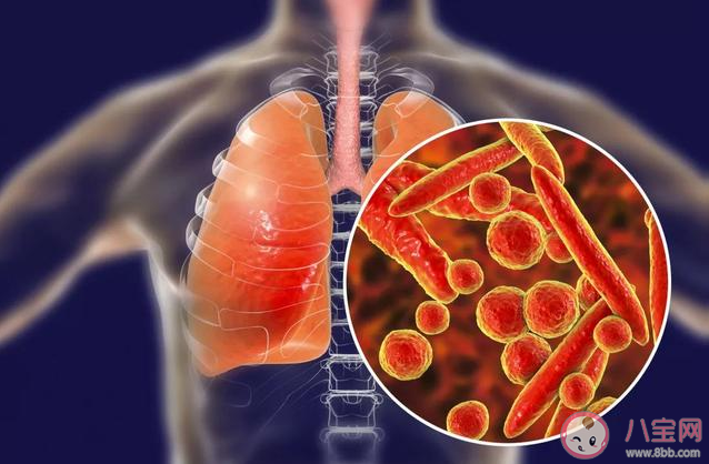 新型冠狀病毒肺炎的致死率高嗎 新型冠狀病毒會人傳人嗎 新型冠狀病毒肺炎的致死率高嗎 新型冠狀病毒會人傳人嗎
