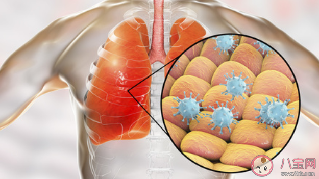 新型冠狀病毒肺炎的致死率高嗎 新型冠狀病毒會人傳人嗎 新型冠狀病毒肺炎的致死率高嗎 新型冠狀病毒會人傳人嗎