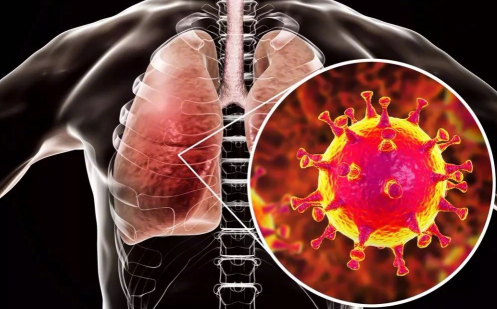 春運期間怎么預防新型冠狀病毒 戴口罩有用嗎