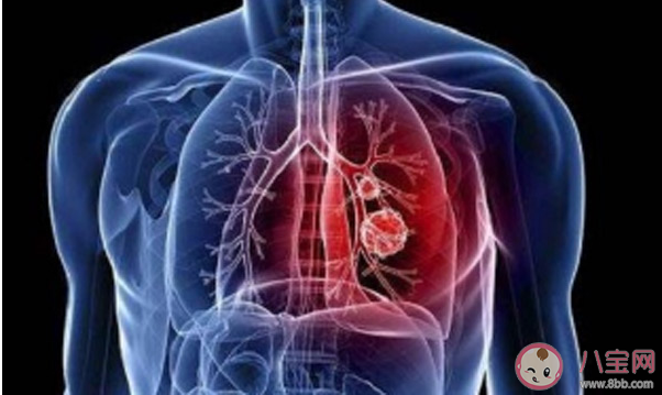 新型冠狀病毒感染了一定會(huì)發(fā)熱嗎 新型冠狀病毒前期的癥狀有哪些