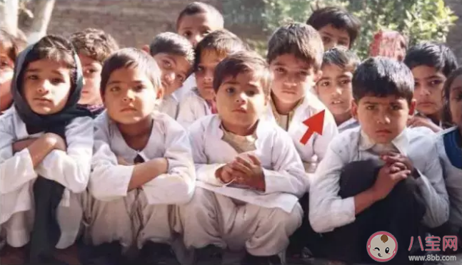 怎么判斷孩子是不是用嘴呼吸 用嘴呼吸的孩子有什么特征