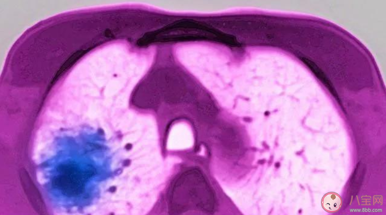 新型冠狀病毒康復(fù)痊愈后會(huì)二次感染嗎 新型冠狀病毒肺炎治愈后能終生免疫嗎