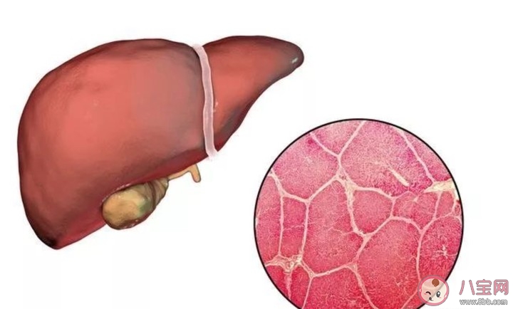 入職體檢有乙肝能過嗎 入職體檢有乙肝五項的項目怎么辦