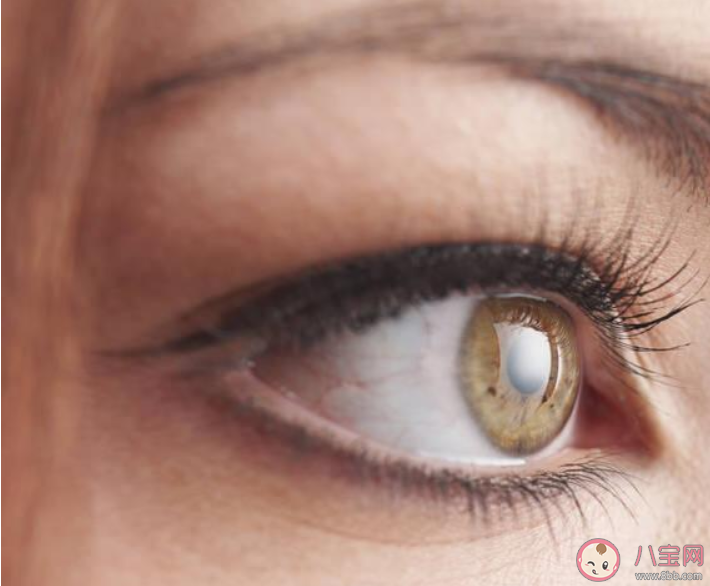 眼淚及結(jié)膜分泌物存在新冠病毒是真的嗎 如何辨別新型冠狀病毒并發(fā)的結(jié)膜炎