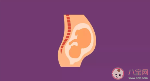 生孩子有選什么分娩方比較好 分娩生孩子順產(chǎn)好孩子剖腹產(chǎn)好