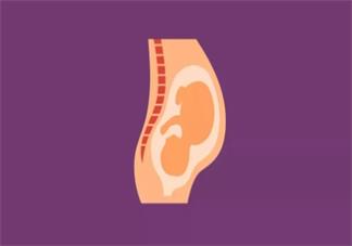 生孩子有選什么分娩方比較好 分娩生孩子順產好孩子剖腹產好