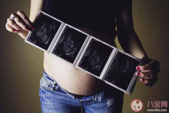 疫情期間準媽媽產檢怎么辦 疫情期間哪些產檢可以不去看