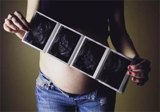 疫情期間準媽媽產檢怎么辦 疫情期間哪些產檢可以不去看