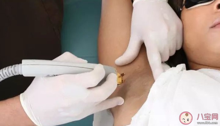 激光脫唇毛多少錢 激光脫唇毛能保持幾年 激光脫唇毛多少錢 激光脫唇毛能保持幾年