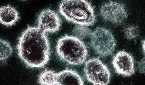 無癥狀感染者會傳染嗎 無癥狀感染者會自己發病嗎 無癥狀感染者會傳染嗎 無癥狀感染者會自己發病嗎