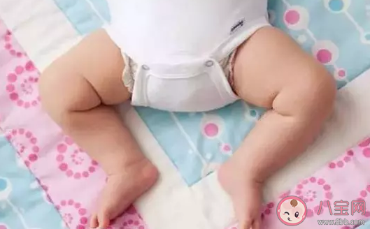 青蛙腿是什么意思 孩子青蛙腿怎么辦 青蛙腿是什么意思 孩子青蛙腿怎么辦