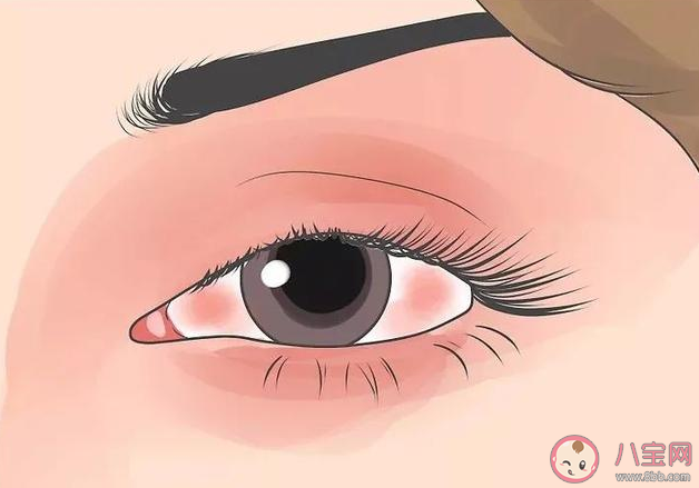 眼皮一直跳怎么辦 怎么減少眼皮跳動的情況出現 眼皮一直跳怎么辦 怎么減少眼皮跳動的情況出現